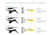 Bild von INTELECT FOCAL SHOCKWAVE SET - CHATTANOOGA